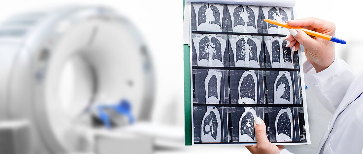 Radiologe zeigt auf Aufnahmen einer Lunge; im Hintergrund ein CT-Gerät