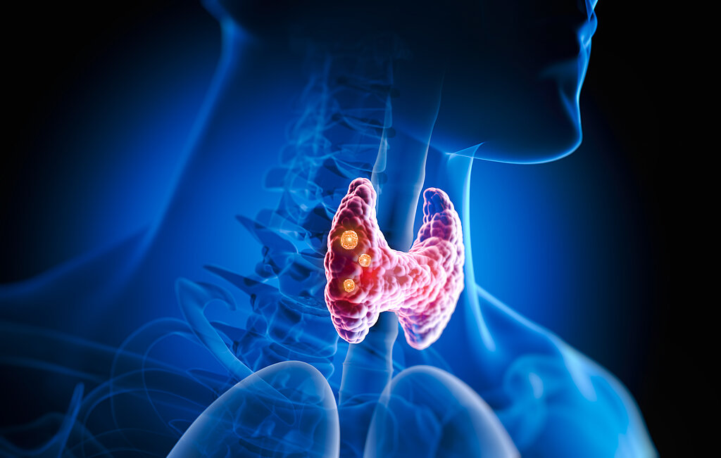 PTA-Fortbildung zu Jod: Schilddrüse Illustration des Halsbereichs in blau mit Luftröhre und Wirbelsäule; die Schilddrüse schmiegt sich vorn in rot an die Luftröhre.