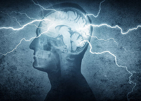 Röntgenbild eines Schädels. Vom Gehirn gehen Blitze aus.