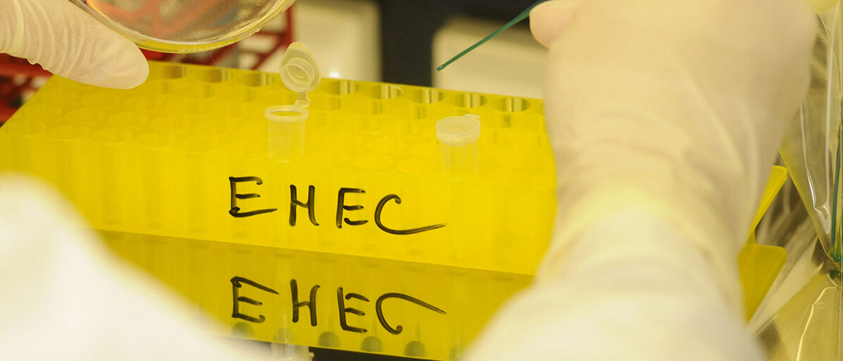 Ehec Untersuchung auf Ehec-Erreger in einem Labor fĂŒr Lebensmittelkontrolle