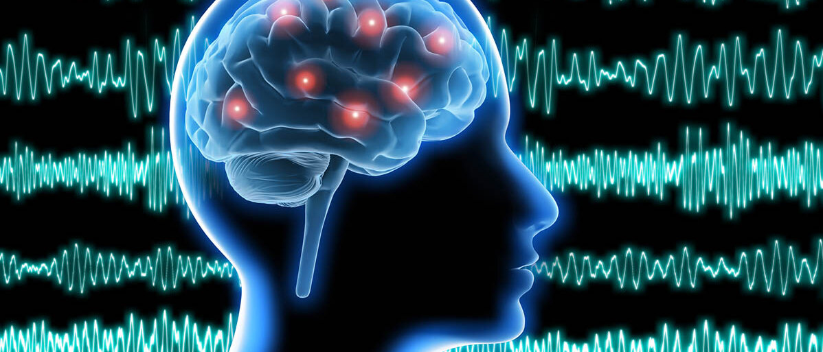 Tiefenhirnstimulation bei Parkinson genau dort, wo nicht-rhythmische Hirnwellen entstehen Illustration eines Kopfes mit Gehirn: An verschiedenen Stellen des Hirns leuchten rote Punkte auf. Im Hintergrund sind verschiedene Arten von Wellen- und Zackenmustern.