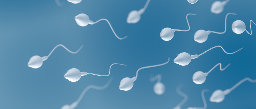 Spermien unter dem Elektronenmikroskop
